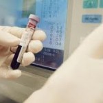 الإصابة بالجلطات ومستويات الحديد بالدم