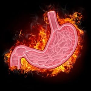 gastritis_def_3386_1