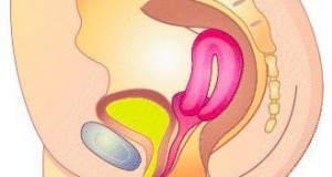 Retroverted Uterus Image Of Retroverted Uterus Pictures to pin on ... Retroverted Uterus Image Of Retroverted Uterus Pictures to pin on ...