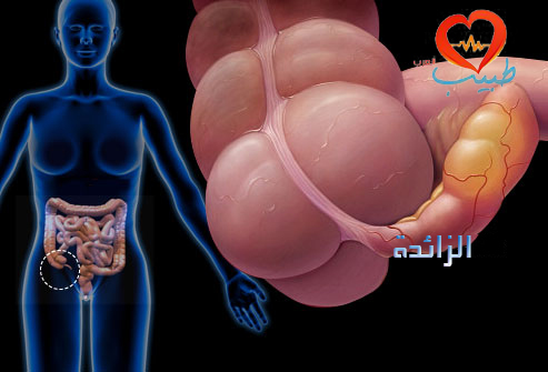 طبيب عرب نسائية الم حوضي زائدة