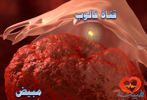 طبيب ع نسائية الم حوضي الم اباضة