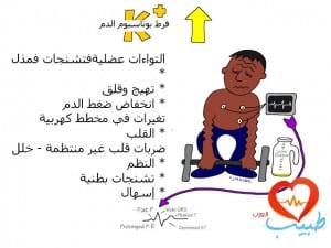طبيب ع فرط بوتاسيوم 1
