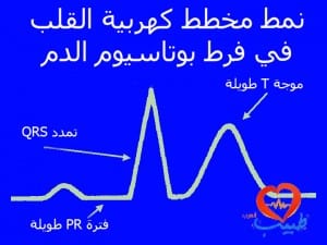 طبيب ع فرط بوتاسيوم