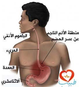 طبيب ع هضم غسر هضم