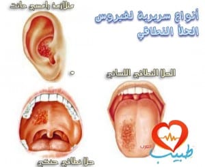 طبيب ع جلدية حزام ناري