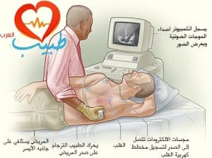 طبيب ع قلبية مخطط صدى القلب