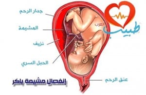 طبيب ع نسائية انفصال
