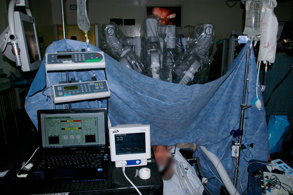 الروبوت دافنشى أثناء العملية الجراحية