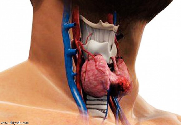 صورة توضح الغدة الدرقية التى تفرز هرمون الثيروكسين