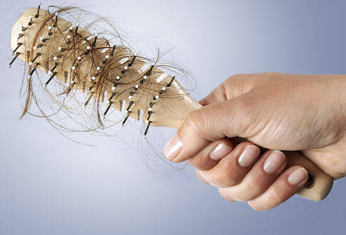 تساقط الشعر أسباب وعلاج مرض تساقط الشعر 