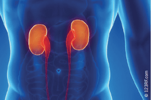 أعراض الفشل الكلوى Renal failure symptoms