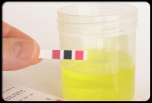 uti_s10_urine_cup_2