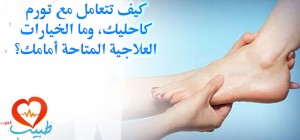 SWOLLEN ANKLE WITH N O PAIN