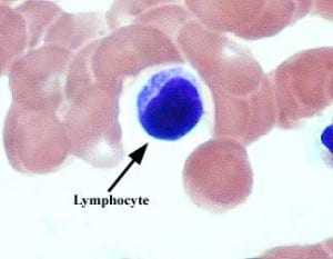 lymphocyte