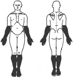 body-chart-peripheral-neuropathy