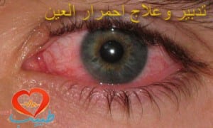 pink_eye1