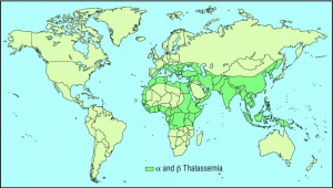 thalassemia