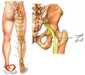 طبيب عر عصبية 3