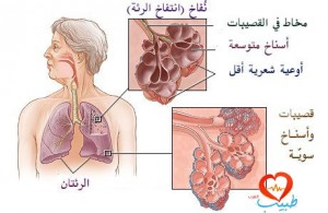 طبيب عرب تنفس 1