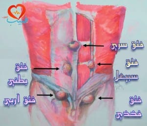 طبيب عرب جراحة 2