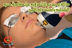 laser-acne-treatment