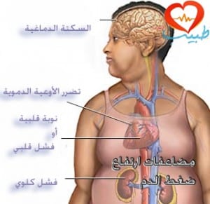 مضاعفات ارتفاع ضغط الدم