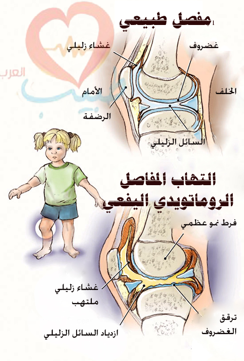 طبيب ع مفاصل 1