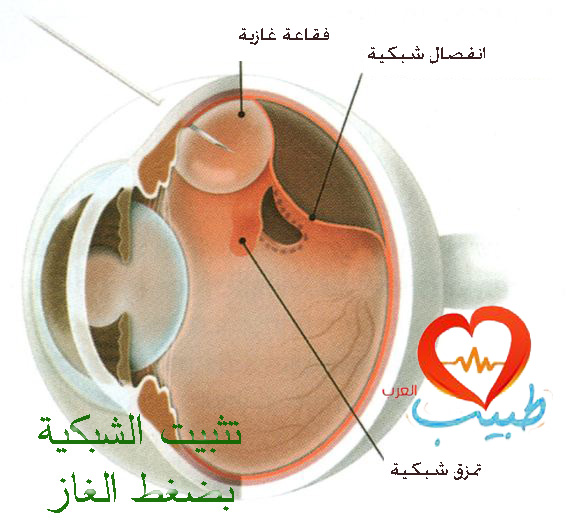 طبيب عرب عيون 13