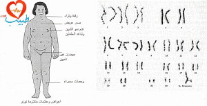 ts1