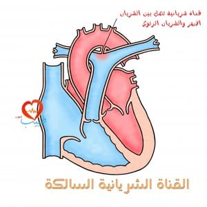 طبيب ع قلبية ثناة شريانية 2