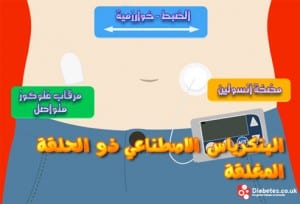 طبيب عرب داخلية بنكرياس صناعي