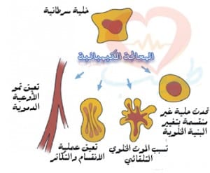 طبيب عرب سرطان معالجة كيميائية 1