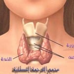 التهاب الغدة الدرقية 