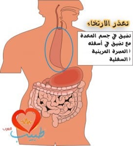 طبيب ع عضمية اكالازيا