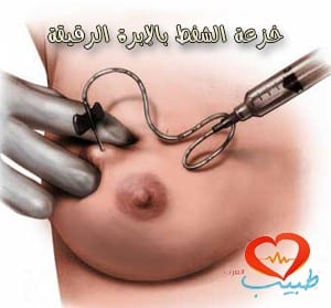 طبيب عرب نسائية خزعة ثدي 2