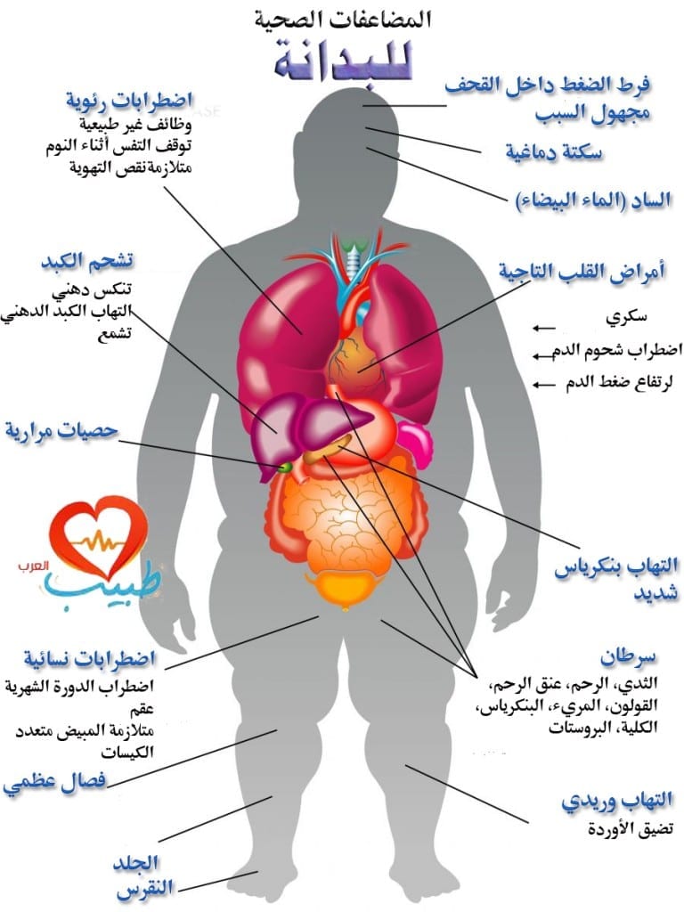 طبيب ع بدانة مضاعفات