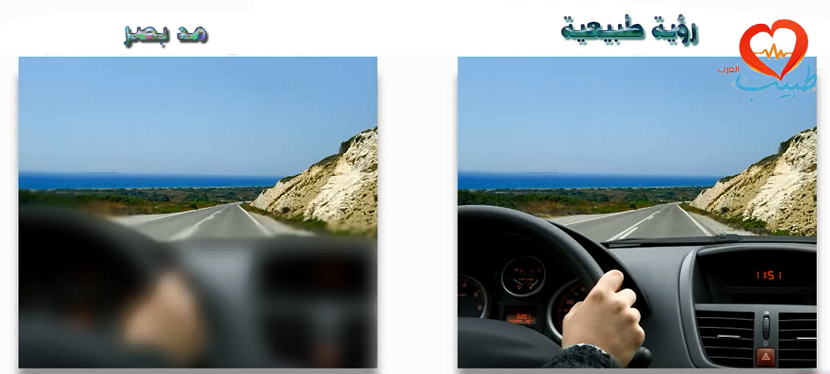 антидождь эффект. шевроле нива вид из кабины. хорошая видимость. хорошая видимость. зрение при астигматизме.