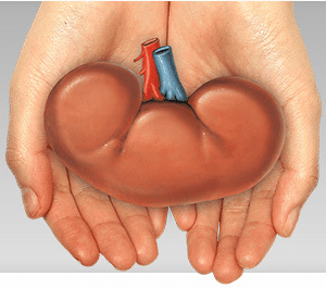 kidney_transplant