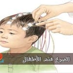 pediatric-convulsion-77-638