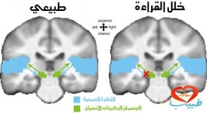 طبيب ع اطفال خلل قراءة