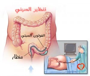 طبيب ع داخلية تنظير سيني