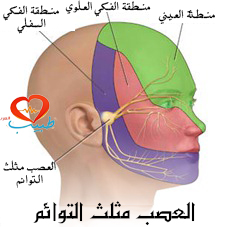 ألم العصب مثلث التوائم ( Trigeminal neuralgia ): أسبابه وأعراضه وعلاجه