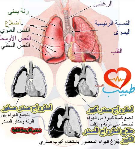 القفص الصدري في ريح أعراض البرد