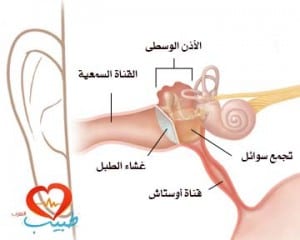 طبيب ع اذن التهاب مصلي