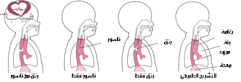 طبيب ع رتق 4