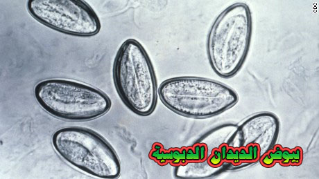 الديدان الدبوسية ( الحرقص ) Pinworms