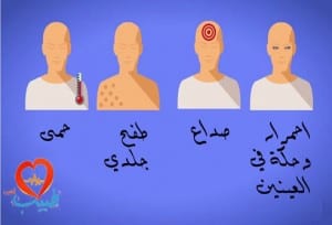 طبيب-ع-داخلية-زيكا-اعراض