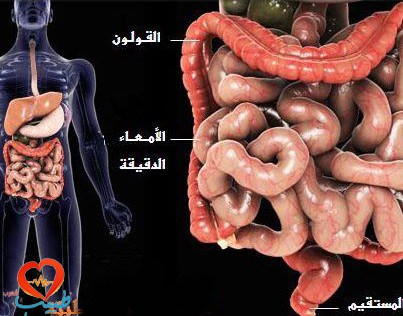 علاج الإمساك المزمن