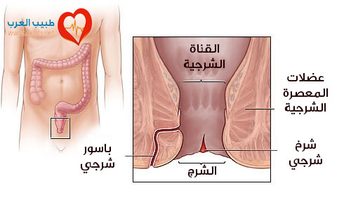 علاج الشرخ الشرجي، علاج الشق الشرجي ، علاج الشرخ الشرجي بالأدوية