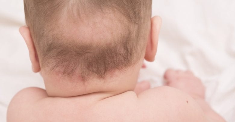 تساقط شعر الأطفال الرضع